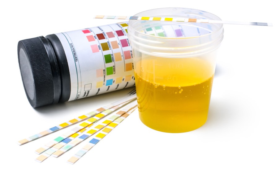 Synthetic Urine Pee Magnolia TX 77355